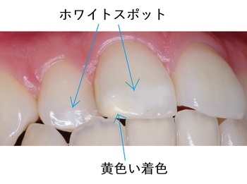 IMGP1589 (2).JPGのサムネール画像